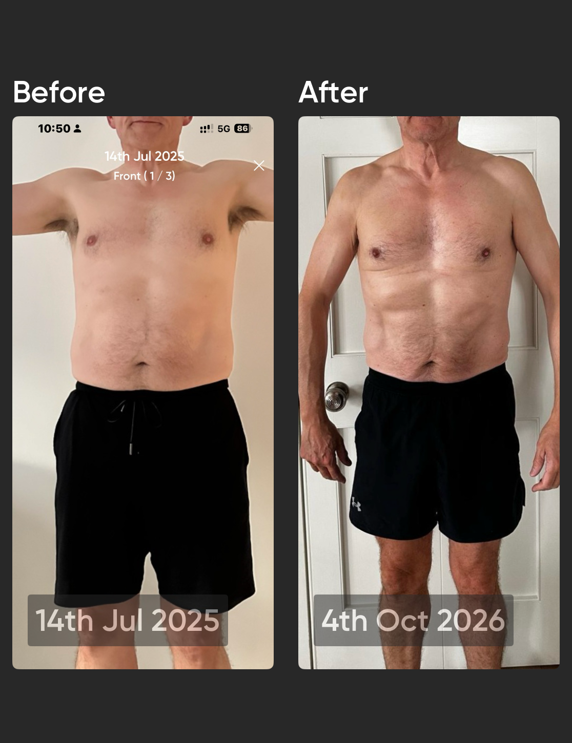 Derek before and after, front view - 14th Jul 2025 to 4th Oct 2026