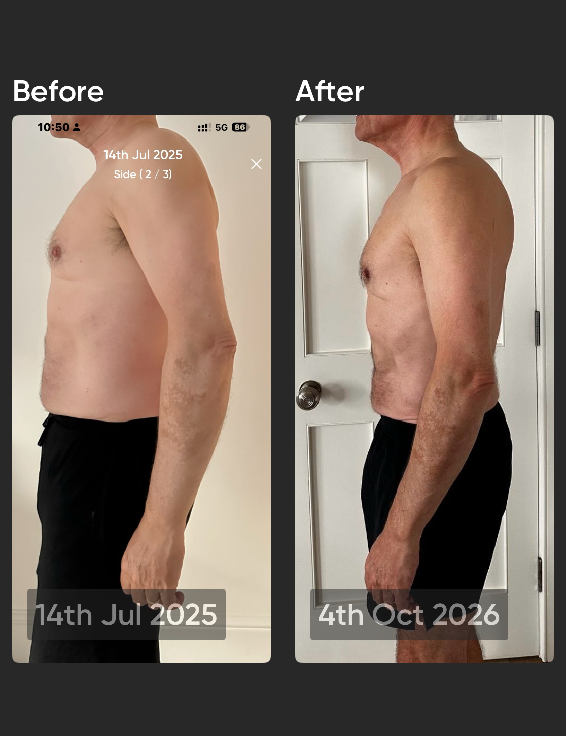 Derek before and after, side view - 14th Jul 2025 to 4th Oct 2026